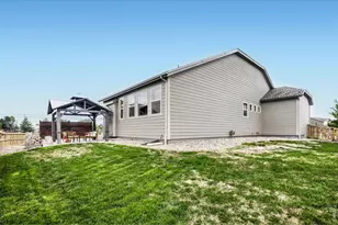 5107 Odessa Lake St, Timnath, CO 80547 - Photo 26