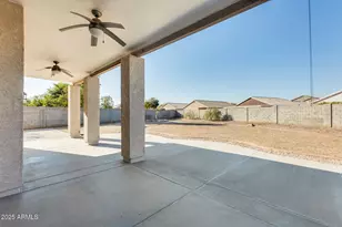 14614 N 153rd Ct, Surprise, AZ 85379 - Photo 4