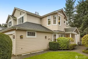 18391 NE 97th Ct, Redmond, WA 98052 - Photo 2