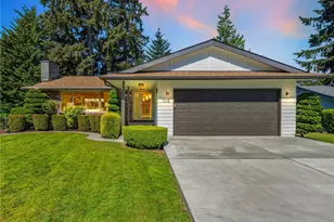 1035 147th Ave SE, Bellevue, WA 98007 - Photo 2