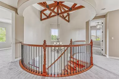 9611 Sunset Hill Drive, Lone Tree, CO 80124 - Photo 2