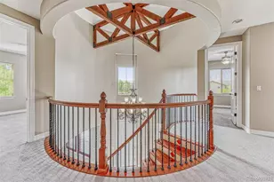 9611 Sunset Hill Dr, Lone Tree, CO 80124 - Photo 2