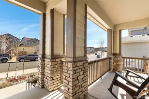 3945 Forever Cir, Castle Rock, CO 80109 - Photo 10