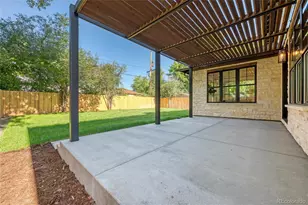 1035 N Leyden St, Denver, CO 80220 - Photo 30